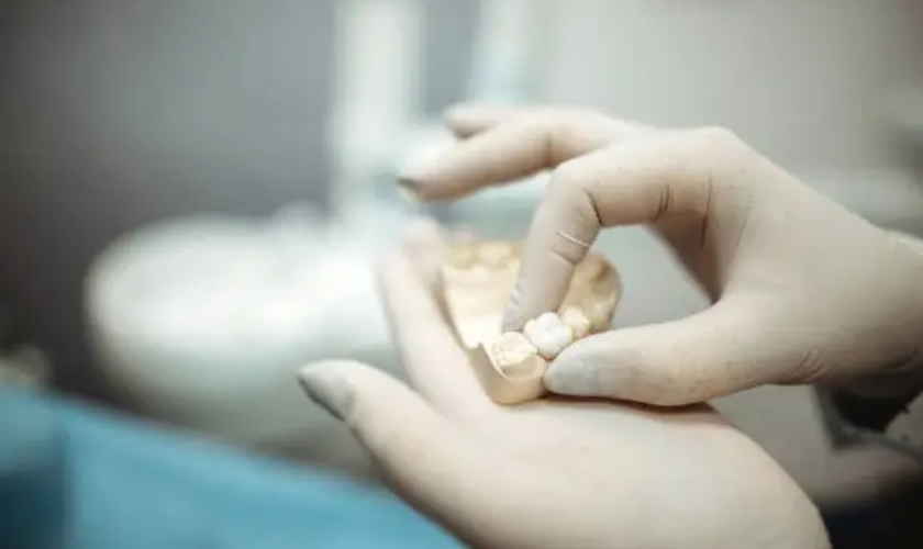 how to care for your dental crown