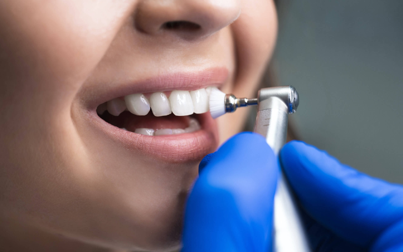 When Should You Get A Dental Cleaning