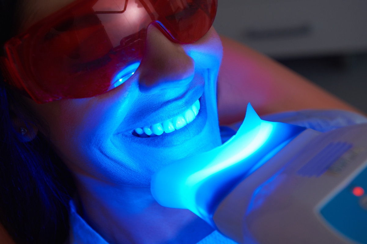 teeth-whitening-in-fisherville