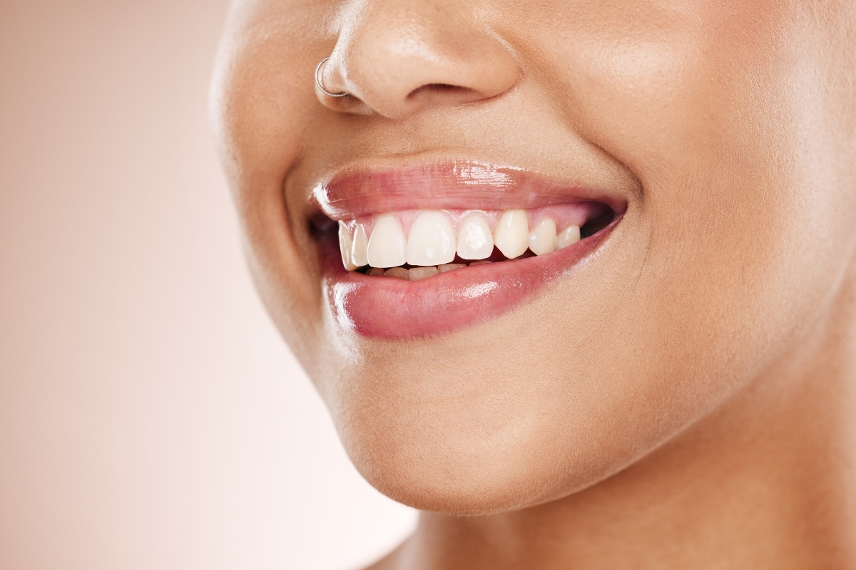 teeth-whitening-in-fisherville-ky